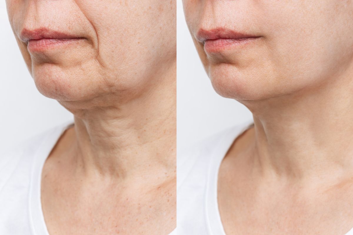 trattamento anti age viso
