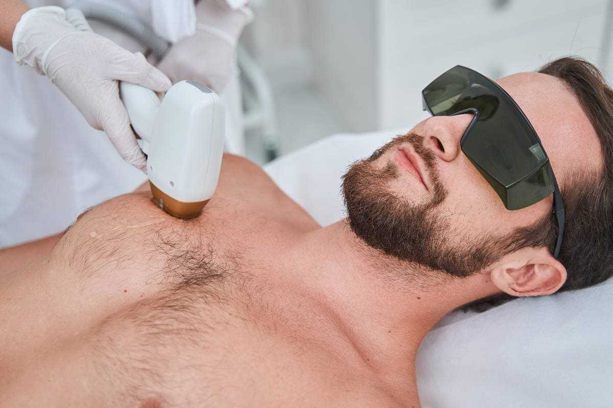Epilazione laser uomo funziona davvero