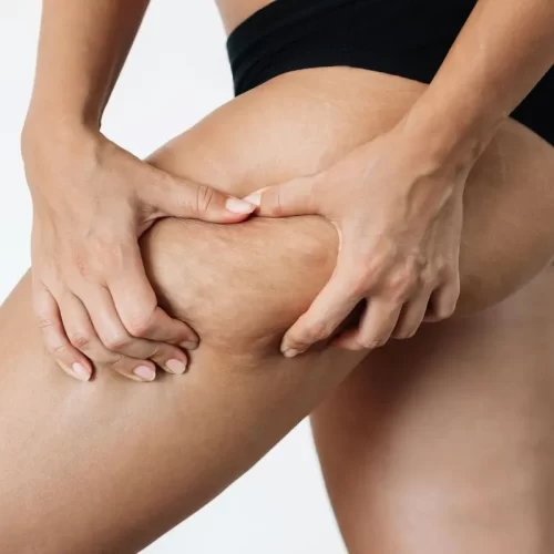 Trattamenti per corpo quali sono i più richiesti in vista dell’estate