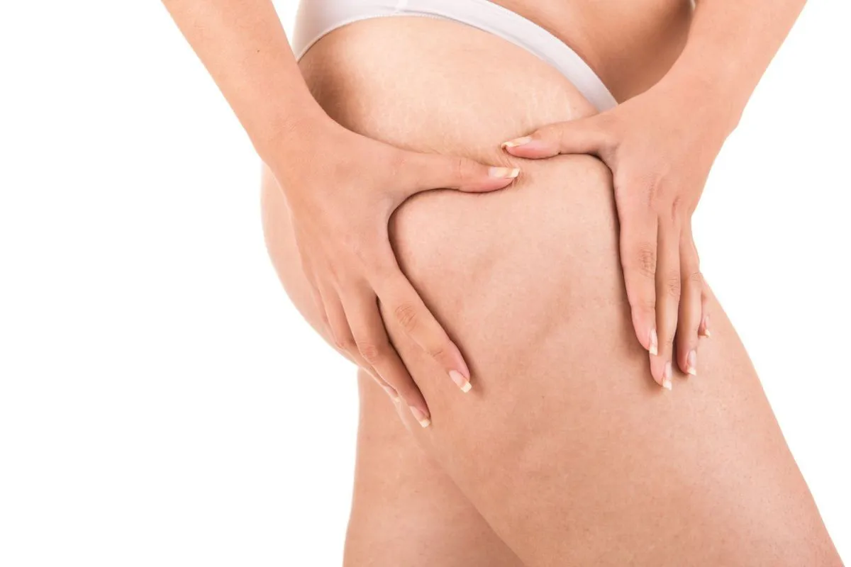 Cellulite e ritenzione idrica: trattamenti estetici più efficaci nei centri professionali